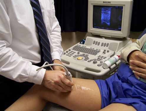 ultrasound, doppler