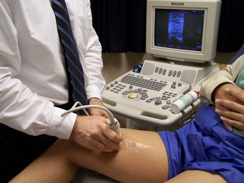 ultrasound, doppler
